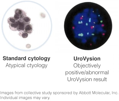 cytology-uFISHtestresult.jpg