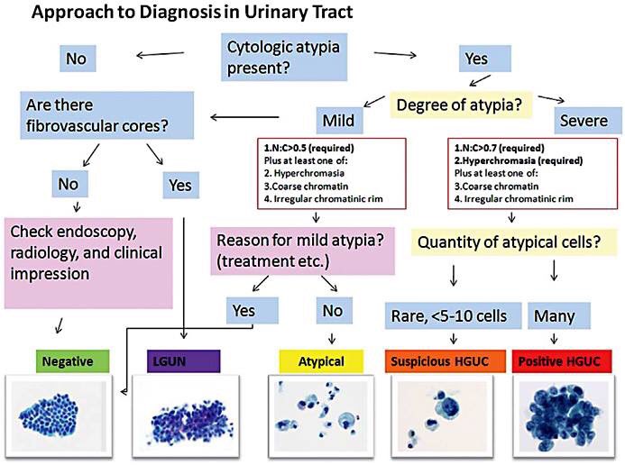 paris-urinary-cytology.jpg